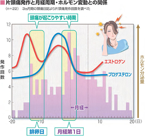 片頭痛発作と月経周期・ホルモン変動との関係